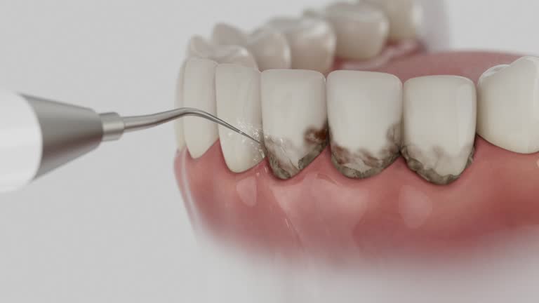 Reliable Dental Implants contractor in Thiensville, WI by Smile Center Dentistry
